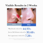 Zero Pore Pad 2.0 – Ergebnisse