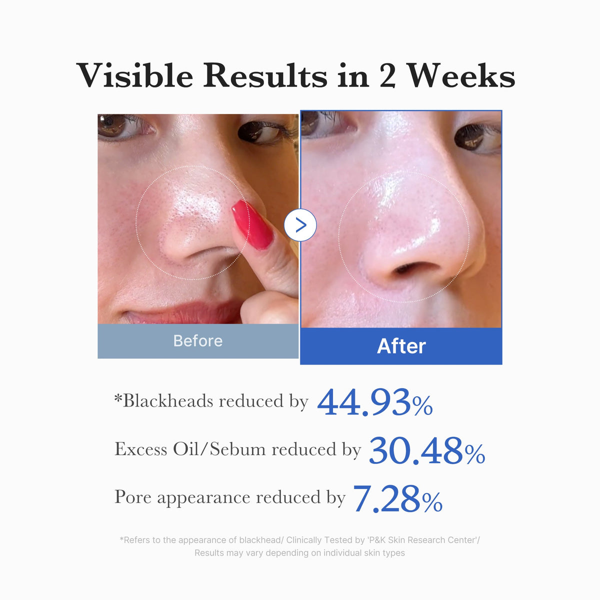 Zero Pore Pad 2.0 – Ergebnisse